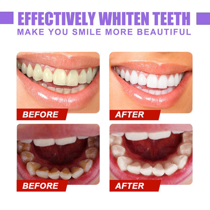2023 Teeth Colour Corrector Serum