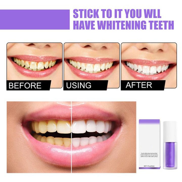2023 Teeth Colour Corrector Serum